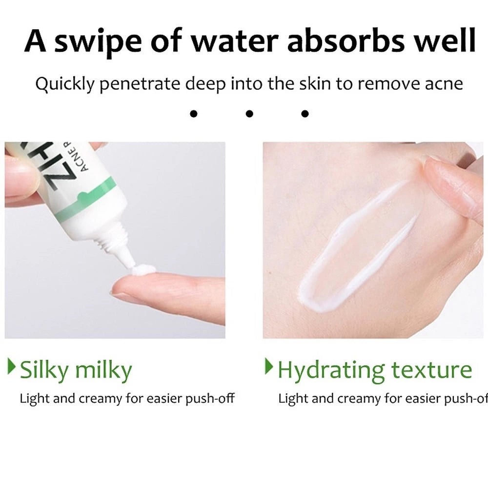 Creme Facial Anti-Acne com Ácido Salicílico para Remover Óleo e Cabeça Preta, Clareador de Cicatrizes
