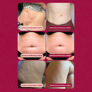 Popozuda Skin Treatment Multifunctional Body Cream 200g/ 7.04 oz.