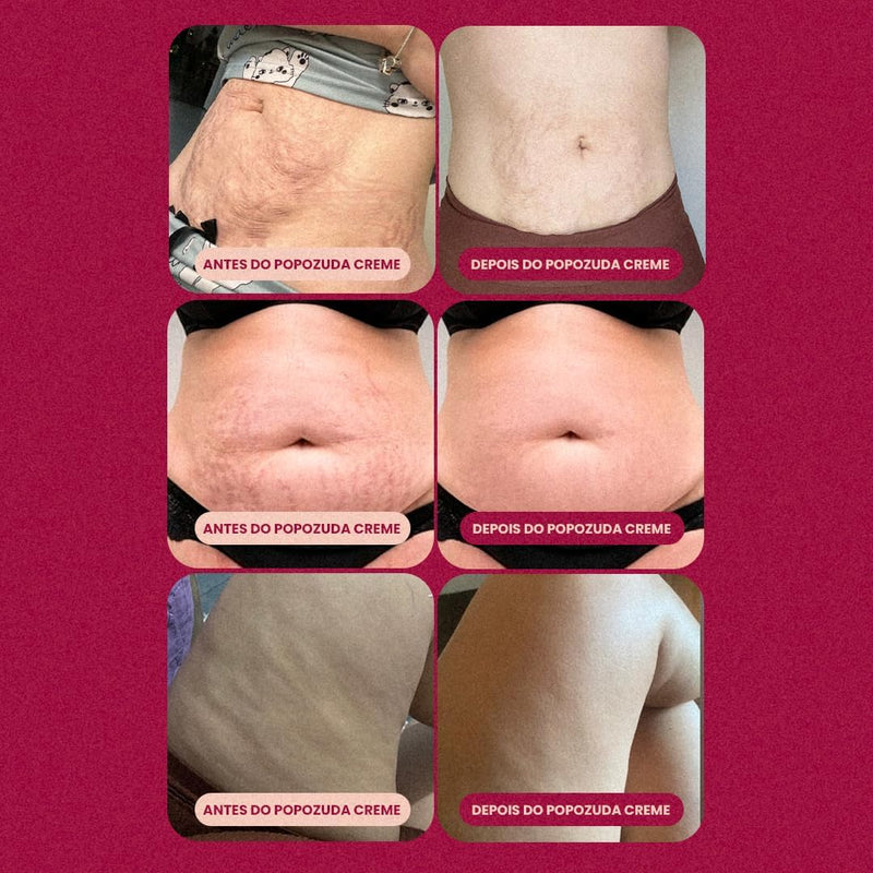 Popozuda Skin Treatment Multifunctional Body Cream 200g/ 7.04 oz.