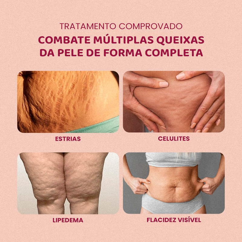 Popozuda Skin Treatment Multifunctional Body Cream 200g/ 7.04 oz.