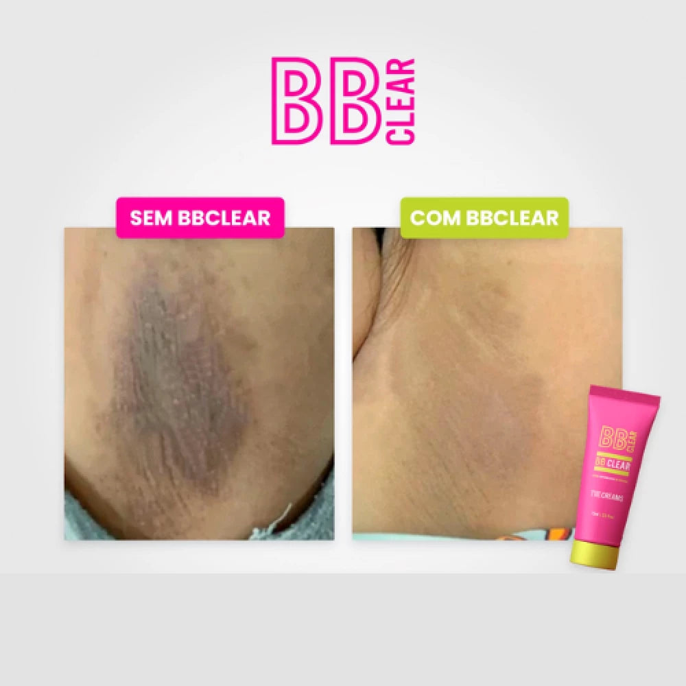 BB Clear – Advanced Skin Brightening &amp; Corrective Cream for Face &amp; Body