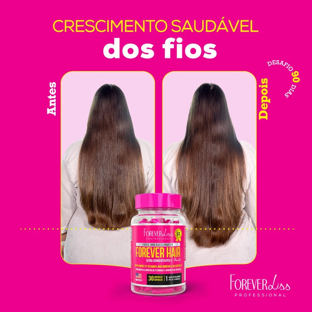 Forever Hair Crescimento Capilar Tratamento 30 Dias