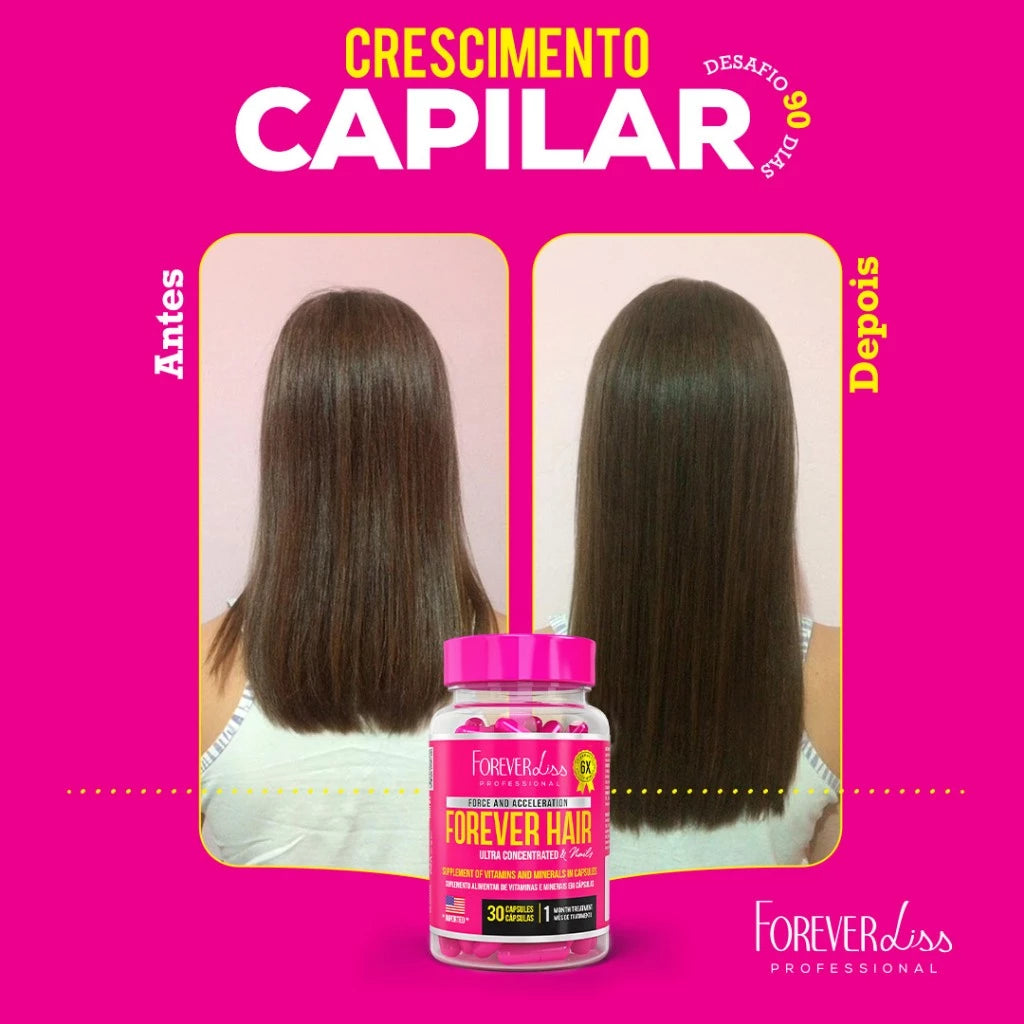Forever Hair Crescimento Capilar Tratamento 30 Dias