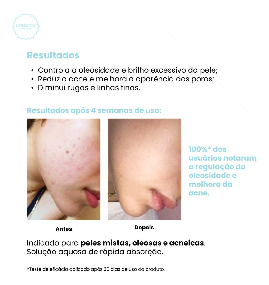 Creamy Skincare Salicylic Acid 90ml | Smoothes Fine Lines Quick Absorption Reduces Excessive Shine Reduces Blackheads Combination Oily Skin Night and Day Use - BuyBrazil