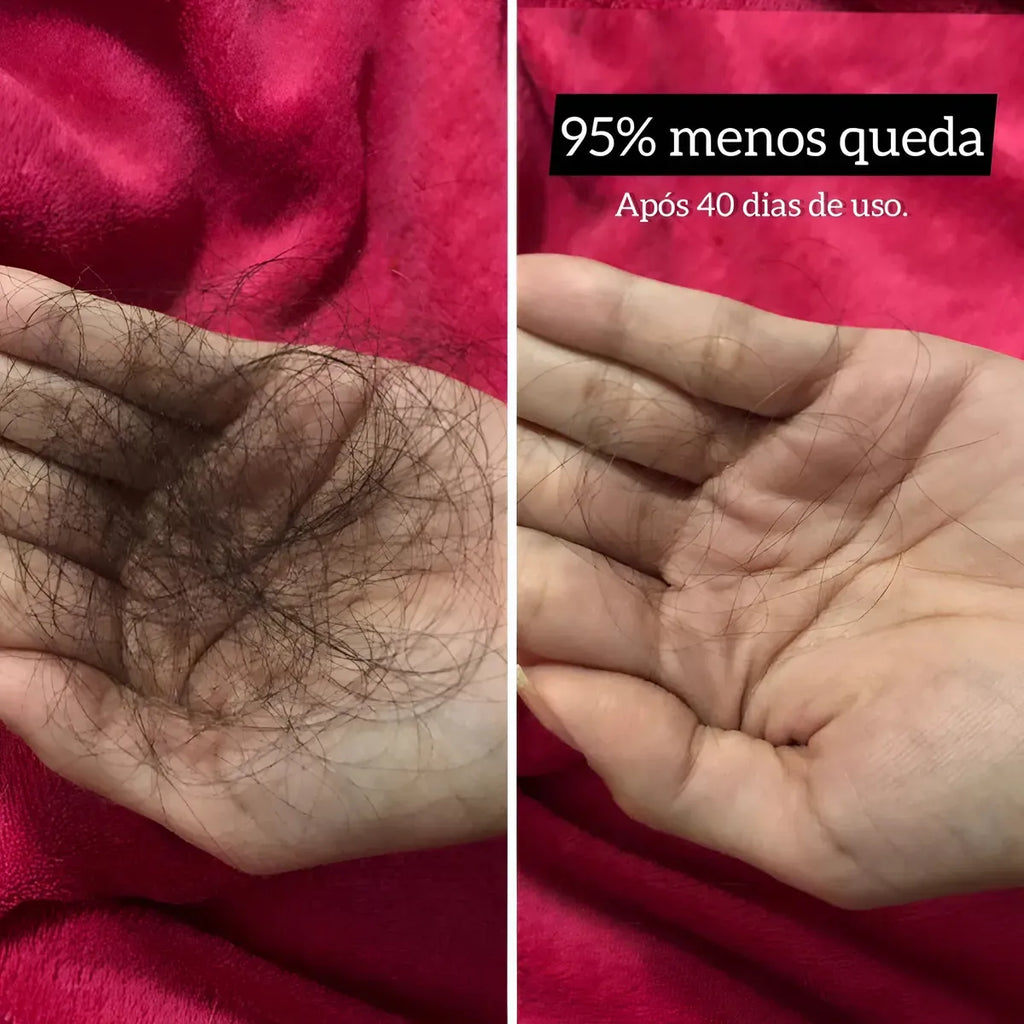 Lizz Ante SOS Crescimento Kit Shampoo 300ml /Mask 300g /Tonic 100ml - BuyBrazil
