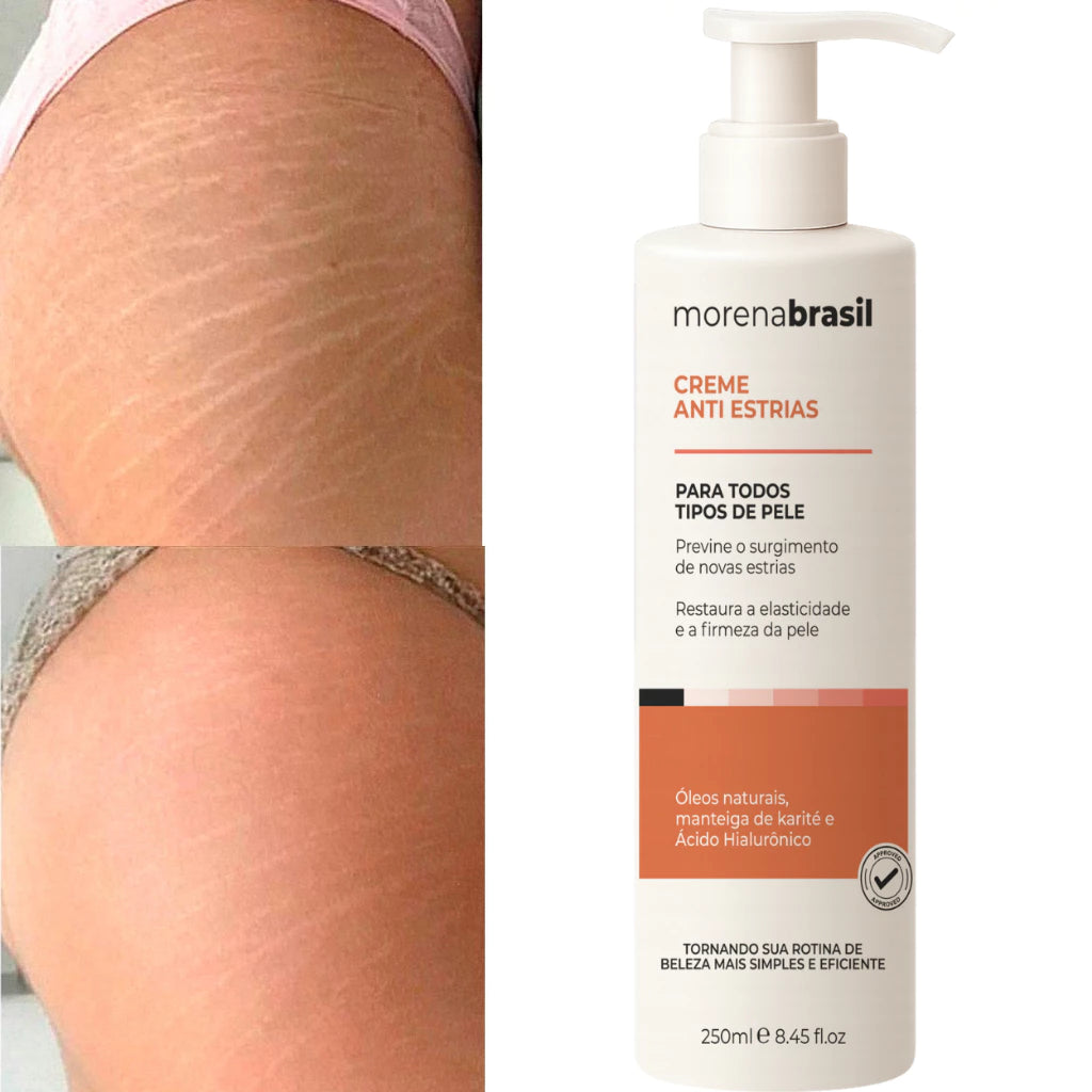 Morena Brasil Anti-Stretch Mark Cream – Advanced Recovery with Collagen & Elastin 250ml/ 8.45fl.oz.