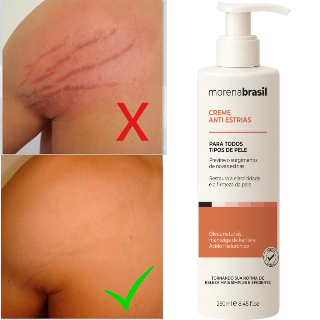 Morena Brasil Anti-Stretch Mark Cream – Advanced Recovery with Collagen & Elastin 250ml/ 8.45fl.oz.