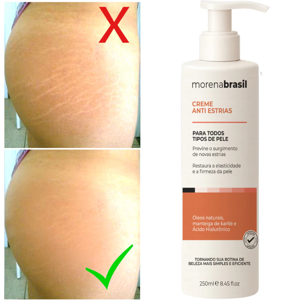 Morena Brasil Anti-Stretch Mark Cream – Advanced Recovery with Collagen & Elastin 250ml/ 8.45fl.oz.