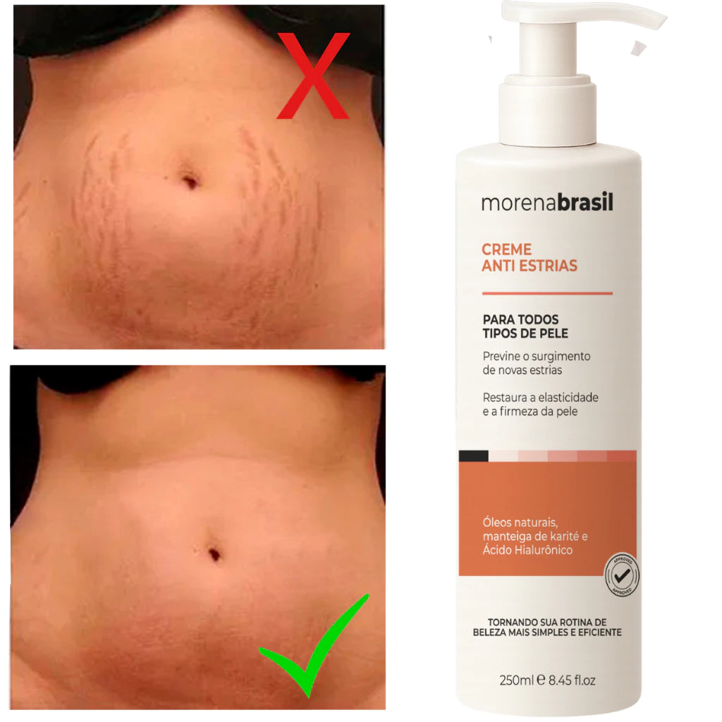 Morena Brasil Anti-Stretch Mark Cream – Advanced Recovery with Collagen & Elastin 250ml/ 8.45fl.oz.