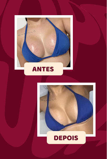 Popozuda Skin Treatment Multifunctional Body Cream 200g/ 7.04 oz.