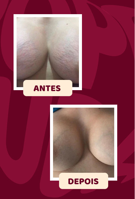 Popozuda Skin Treatment Multifunctional Body Cream 200g/ 7.04 oz.