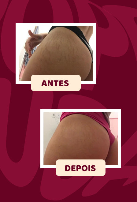 Popozuda Skin Treatment Multifunctional Body Cream 200g/ 7.04 oz.